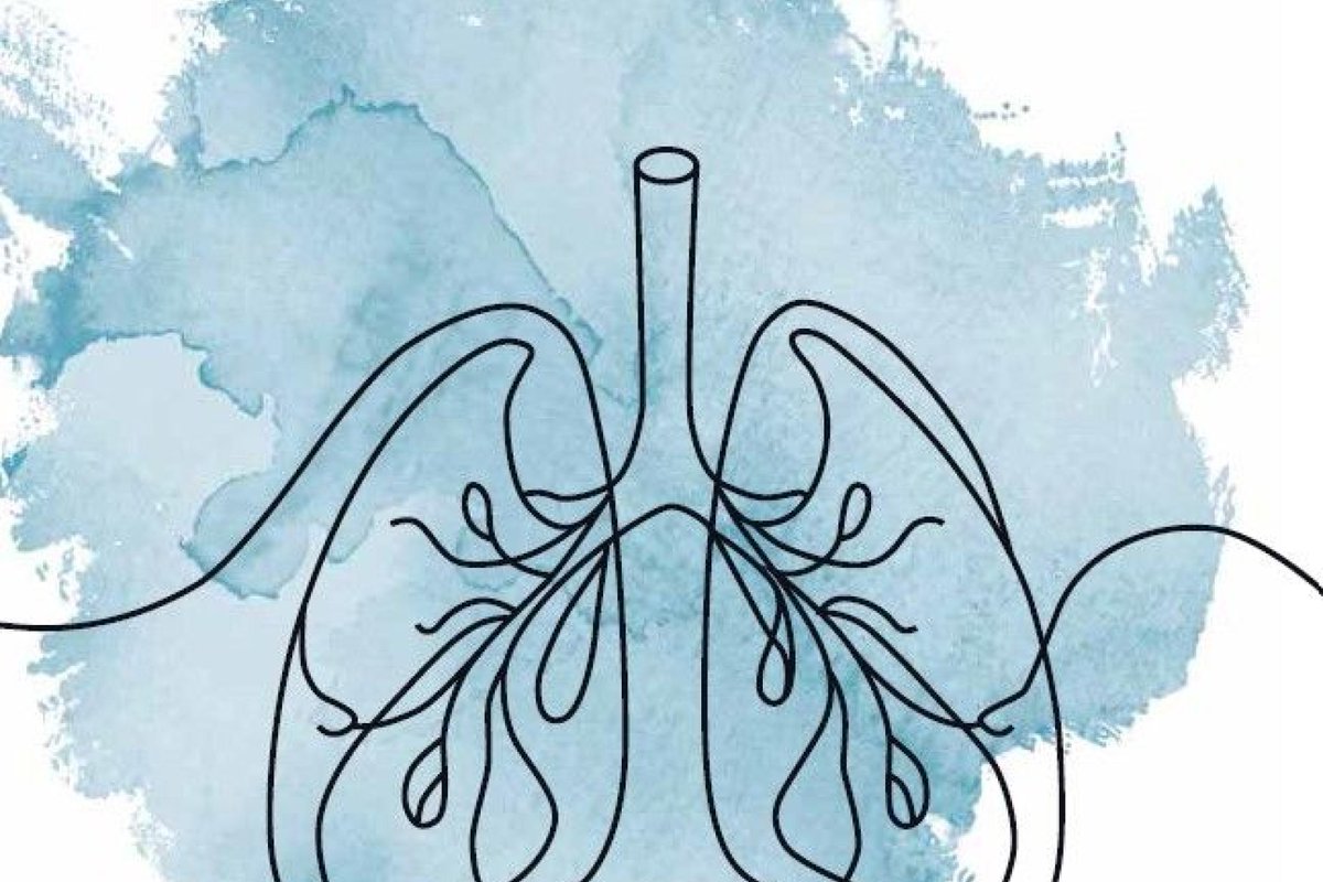CARIM (@carimmaastricht) on Twitter photo #thesisdefence Tomorrow, Judith Gulikers will defend the thesis 'Improving effective and safe use of targeted therapies in non-small cell lung cancer' at 10:00h <a href="/MaastrichtU/">Maastricht University</a>
📺youtube.com/@UMphddefense/…
#phdlife #thesisdefence Tomorrow, Judith Gulikers will defend the thesis 'Improving effective and safe use of targeted therapies in non-small cell lung cancer' at 10:00h <a href="/MaastrichtU/">Maastricht University</a>
📺youtube.com/@UMphddefense/…
#phdlife