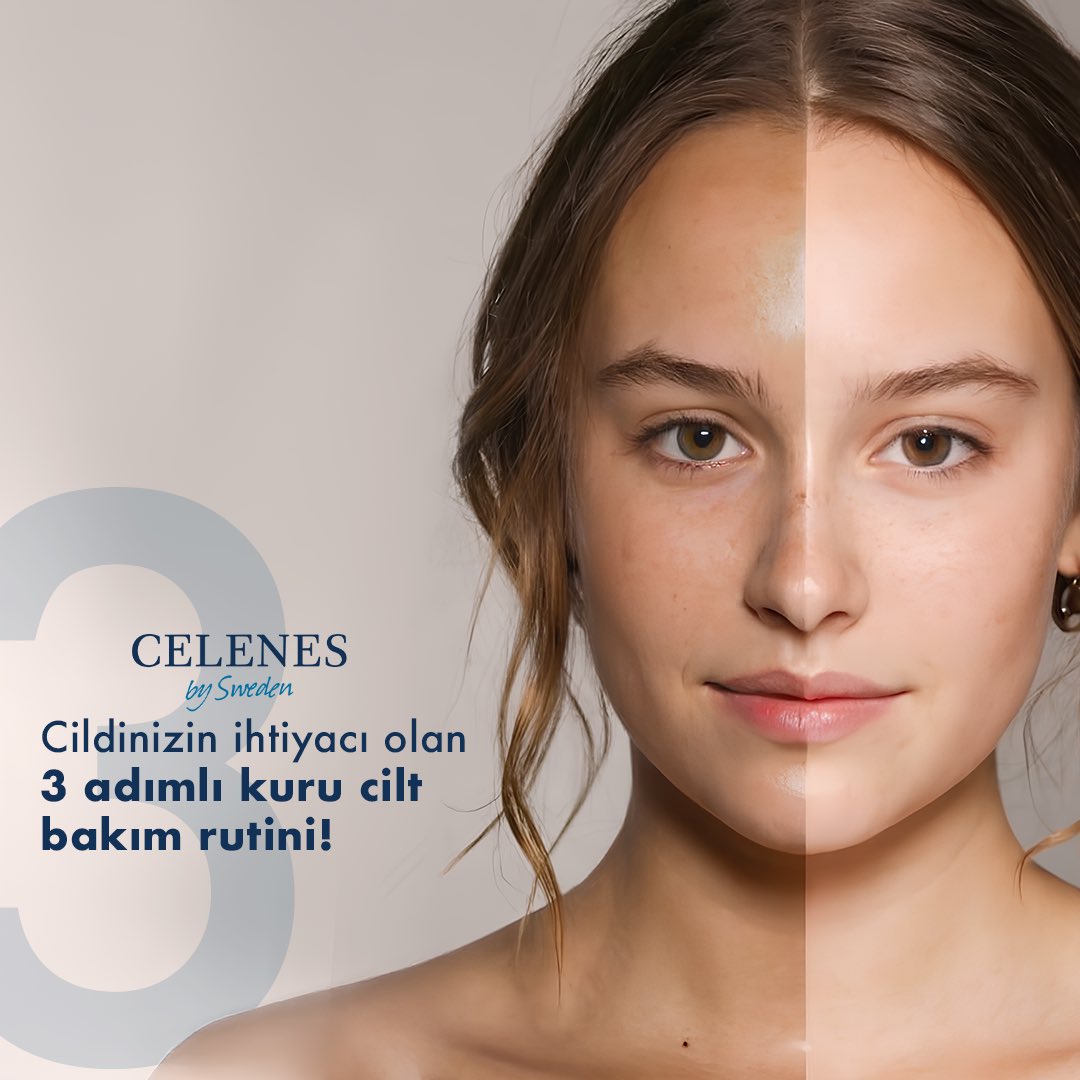 Celenes Türkiye tweet media