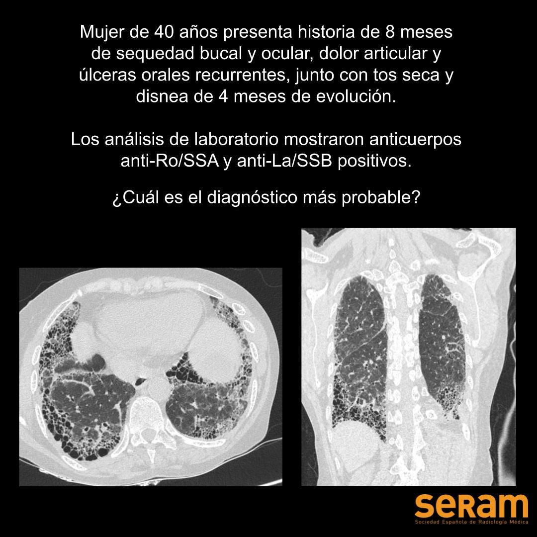 Residentes SERAM tweet media