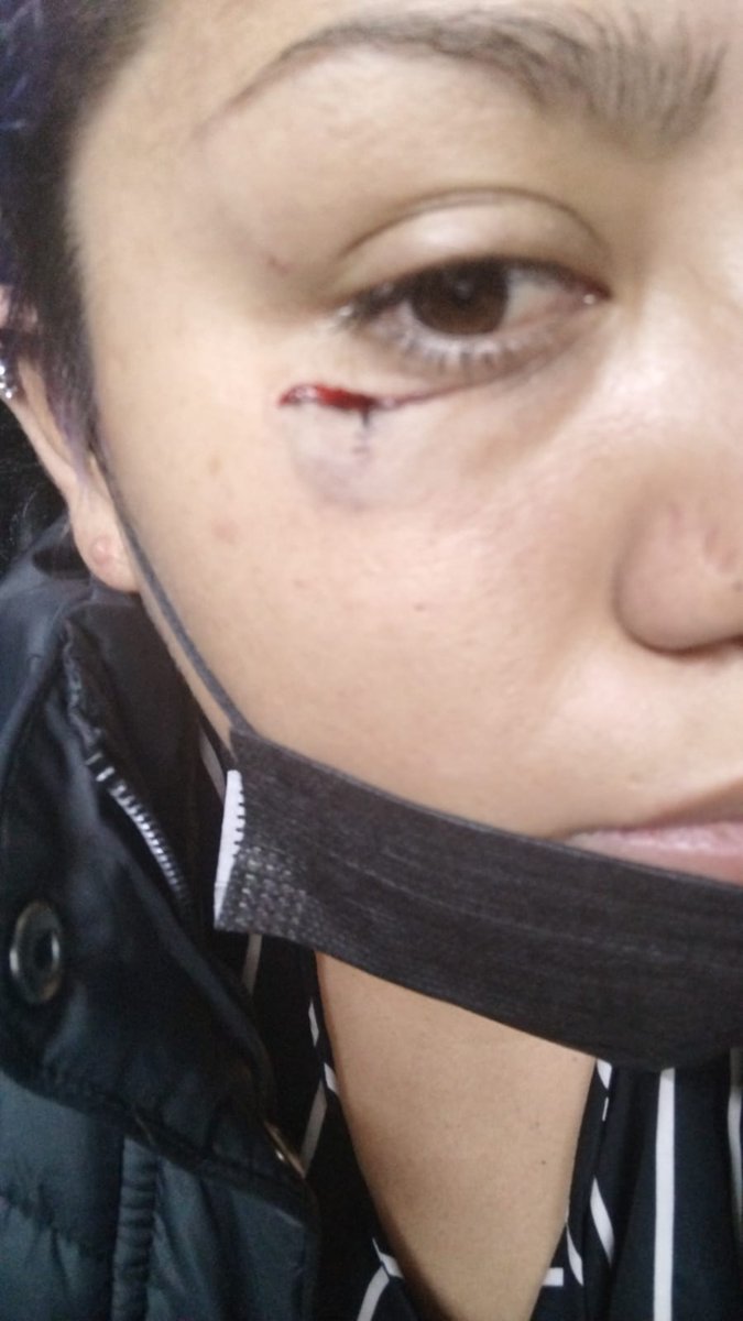 MaraFer9819's tweet photo. @Tu_IMSS  pido que me ayuden. hace una semana sufrí un accidente y en el hospital Lomas Verdes de @Tu_IMSS me trataron mal... su enfermeros ligando, comiendo paletas, donde debe ser un lugar esteril... me tardardaron 5 horas en suturarme... y la enfermera se burló de mi.. AYUDA https://t.co/KrmGtHkt3O
