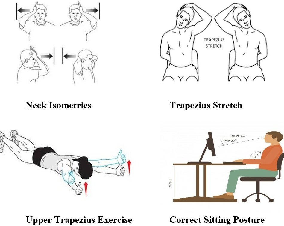 Emeemashaji2000's tweet photo. Trapezitis is an inflammation caused in the trapezius muscles which further leads to pain and spasm, stiffness in the neck muscles. Physiotherapy management are neck isometrics,stretching, postural correction etc.
#exercise #trapezitis https://t.co/T9nUWVBrPp