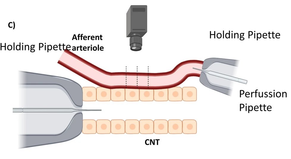 Tengis Pavlov (@cardiorenalrese) on Twitter photo Rabbit afferent arterioles (Af-Arts) with adjacent CNTs were microperfused with variable flow rates and Na+ concentrations. Involvement of ENaC, O2- production and NOS in the flow-induced Af-Art dilation were studied. <a href="/HFHypertension/">Henry Ford Hypertension and Vascular Research</a> <a href="/cesarom1/">Cesar A. Romero</a> <a href="/313Kidney/">POrtiz_313_Kidney</a>
link.springer.com/article/10.100… Rabbit afferent arterioles (Af-Arts) with adjacent CNTs were microperfused with variable flow rates and Na+ concentrations. Involvement of ENaC, O2- production and NOS in the flow-induced Af-Art dilation were studied. <a href="/HFHypertension/">Henry Ford Hypertension and Vascular Research</a> <a href="/cesarom1/">Cesar A. Romero</a> <a href="/313Kidney/">POrtiz_313_Kidney</a>
link.springer.com/article/10.100…