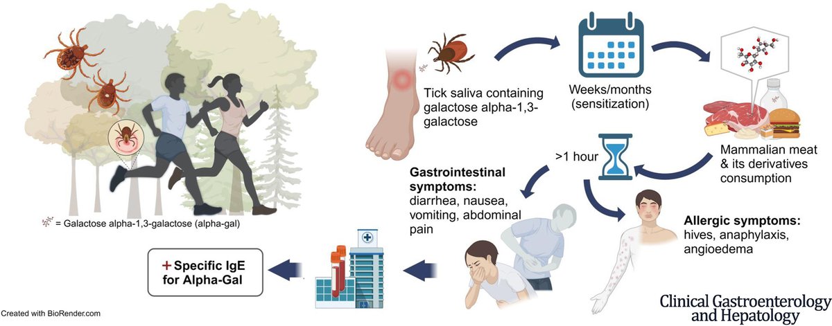 CGH (@aga_cgh) on Twitter photo Diagnosis of AGS should be strongly considered in patients with a history of tick bites and clinical presentation of allergic or GI manifestations. Dietary intervention is effective in most but not all patients: ow.ly/G6Pq50UB6ke
<a href="/mgrover_gi/">Madhusudan (Madhu) Grover M.D., AGAF</a>
<a href="/lesmana_elvira/">Elvira Lesmana</a>
<a href="/SameerRaoMBBS/">Sameer Rao</a> Diagnosis of AGS should be strongly considered in patients with a history of tick bites and clinical presentation of allergic or GI manifestations. Dietary intervention is effective in most but not all patients: ow.ly/G6Pq50UB6ke
<a href="/mgrover_gi/">Madhusudan (Madhu) Grover M.D., AGAF</a>
<a href="/lesmana_elvira/">Elvira Lesmana</a>
<a href="/SameerRaoMBBS/">Sameer Rao</a>