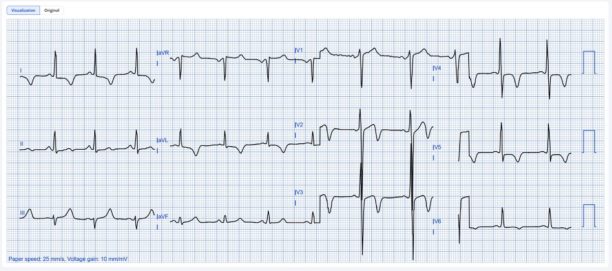 Dr. Andreas Roeschl tweet media