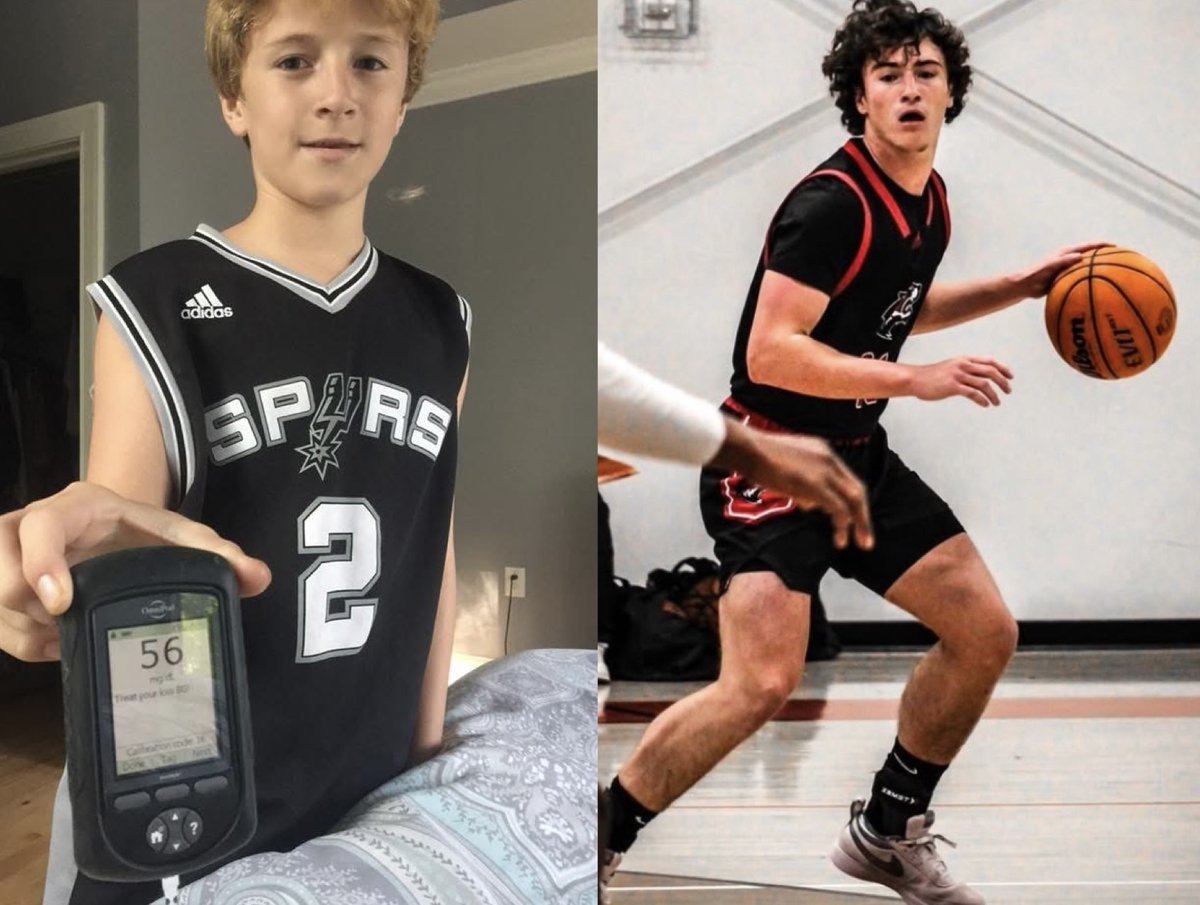 "When I was younger, I used to ask, ‘Why me? Why do I have to deal with this?’ But now, it makes me feel different in a good way.”

Battling Type 1 Diabetes and Ankylosing Spondylitis, how Blue Ridge 🏀 star Paul Bishop became who he always hoped to be:

➡️greersportsstar.com/blue-ridge/dif…