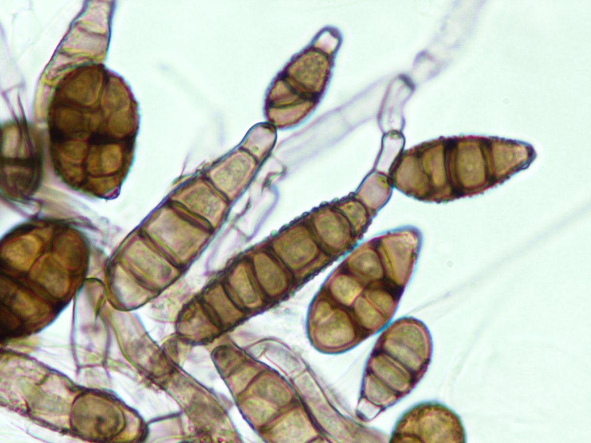 BCCM Collections (@bccmcollections) on Twitter photo #Training at the BCCM/IHEM #Fungi collection in Brussels: "#Moulds of the indoor environment and outdoor air". 
Next sessions: 17-21 March 2025 (in French).
More info: bccm.belspo.be/training/fungi…
#microbiology 
<a href="/belspo/">Belspo</a> <a href="/sciensano/">Sciensano</a> #Training at the BCCM/IHEM #Fungi collection in Brussels: "#Moulds of the indoor environment and outdoor air". 
Next sessions: 17-21 March 2025 (in French).
More info: bccm.belspo.be/training/fungi…
#microbiology 
<a href="/belspo/">Belspo</a> <a href="/sciensano/">Sciensano</a>