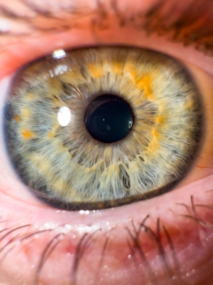 ereece16's tweet photo. This is kind of crazy. A photo of my eye, taken on my iPhone 16 Pro Max 😮 https://t.co/GhfgqSx8qn