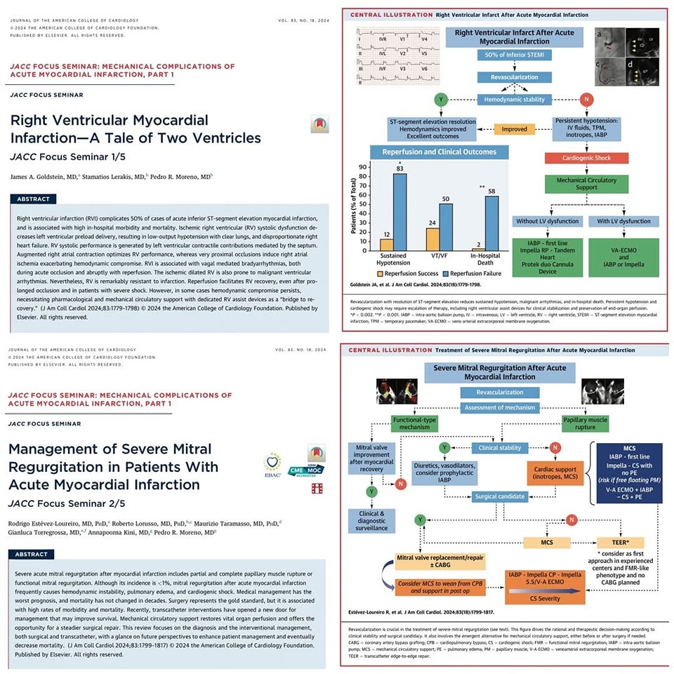 ZHeart11768530's tweet photo. 🔴Top Reviews/series of 2024: @JACCJournals series on Mechanical complications of acute MI

🔴 Right Ventricular MI—A Tale of Two Ventricles:  
✅https://t.co/az9cO4n55J

🔴Management of Severe MR in Patients With Acute MI
✅https://t.co/7CthVRVrmw https://t.co/xnTORgwA9P