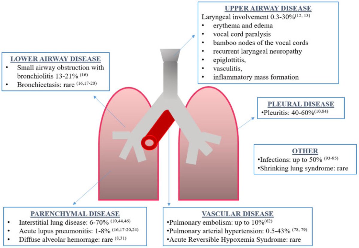 RheumQuarterly's tweet image. respiratory manifestations in #systemic #lupus #erythematosus (#SLE)

ref: pmc.ncbi.nlm.nih.gov/articles/PMC80… 

#firatromatolojisempozyumu
#romatoloji