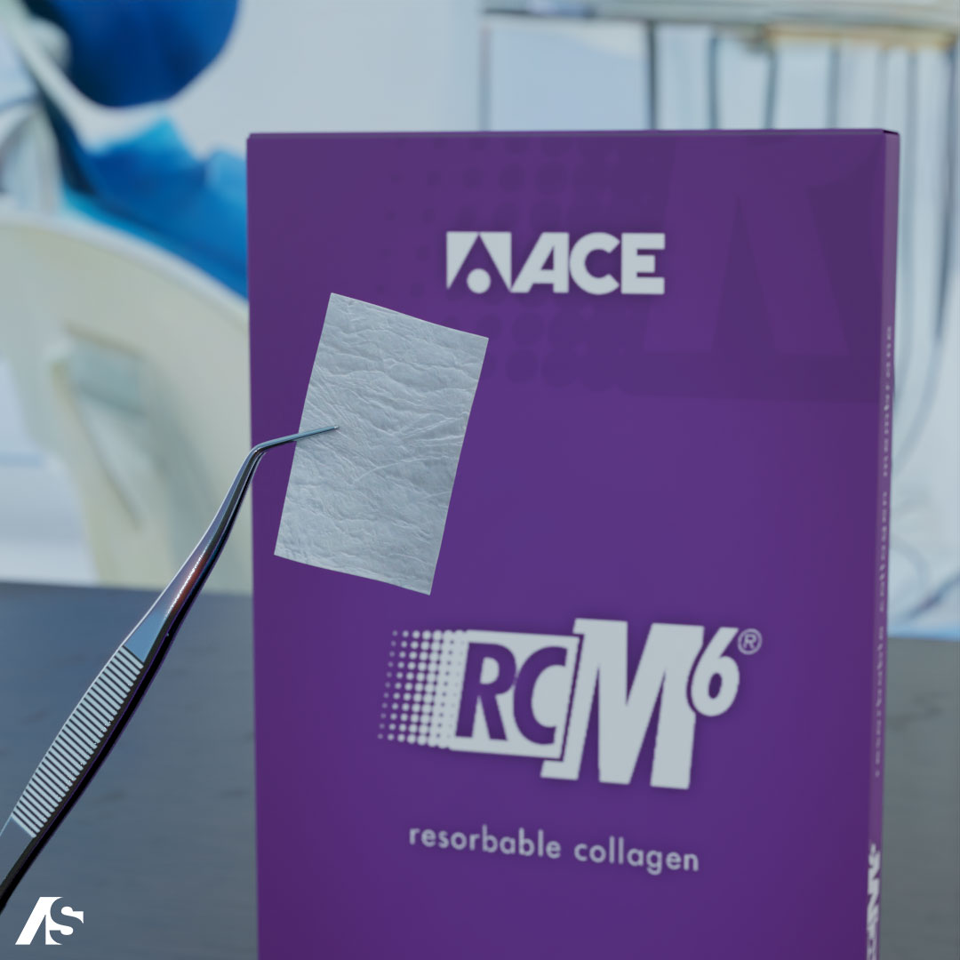 AceSouthern's tweet photo. RCM6 combines versatility &amp; strength. Easily trimmed to fit and placed either side up, it’s designed for ridge augmentations, sinus lifts, periodontal defects &amp; more. Its resorption time of up to 6 months makes it ideal for long-term support.

Learn more: https://t.co/xyAppLPcW1 https://t.co/Ok2k9Fzp6G
