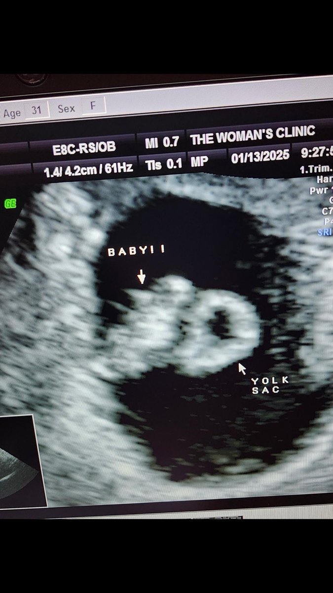 LKSurrogacy's tweet photo. We are thrilled for our incredible surrogate, T, and the intended parents as the baby’s heartbeat has been confirmed! 💕 
This precious little one is already so loved, and we couldn’t be happier to support this beautiful journey. 💖👶 
#SurrogacyJourney
#LoveandHope https://t.co/tzxWY84mHZ