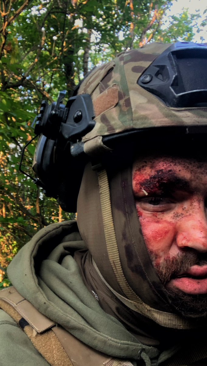 sobol_22_kod's tweet photo. Знаєте чого таке сумне обличчя?
Бо цей збір встав(

 https://t.co/PpU3pxvu9z

4441111129923136 https://t.co/8J9c3CsLP6