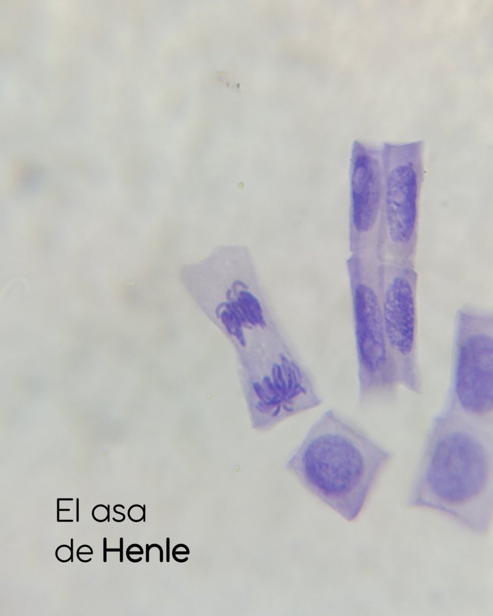 elasadehenle's tweet photo. Cromosomas mitóticos teñidos con hematoxilina. 
Material: Raíz de Allium sativum 🧄 

#citogenetica #hematoxilina #cromosomas #mitosis https://t.co/x4J4HEgEnk