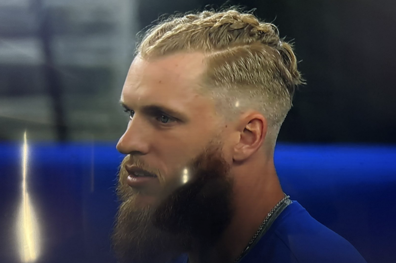 NFL_DovKleiman's tweet photo. 𝗕𝗿𝗲𝗮𝗸𝗶𝗻𝗴: #Rams WR Cooper Kupp has braids tonight.

Massive game incoming 😤 https://t.co/K7jnwLV2b4
