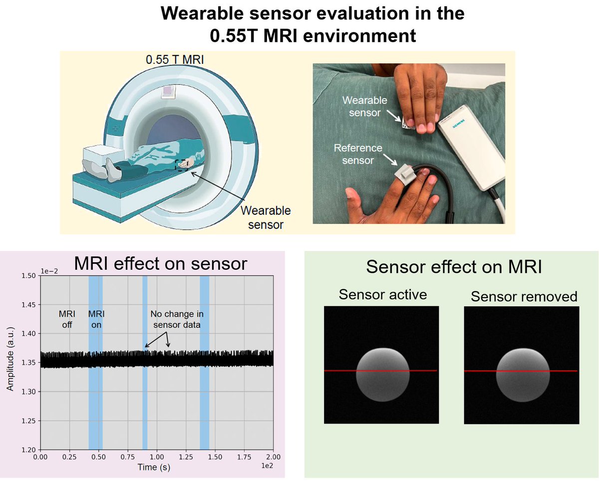 Yasser Khan (@khanlabusc) on Twitter photo #wearables inside #MRI ? 🤔We demonstrated a custom wearable sensor operating in a low-field (0.55T) MRI scanner. We evaluated noise in a wearable device caused by eddy currents from the rapidly switching MRI gradients, as well as the MRI noise and artifacts introduced by the BLE #wearables inside #MRI ? 🤔We demonstrated a custom wearable sensor operating in a low-field (0.55T) MRI scanner. We evaluated noise in a wearable device caused by eddy currents from the rapidly switching MRI gradients, as well as the MRI noise and artifacts introduced by the BLE