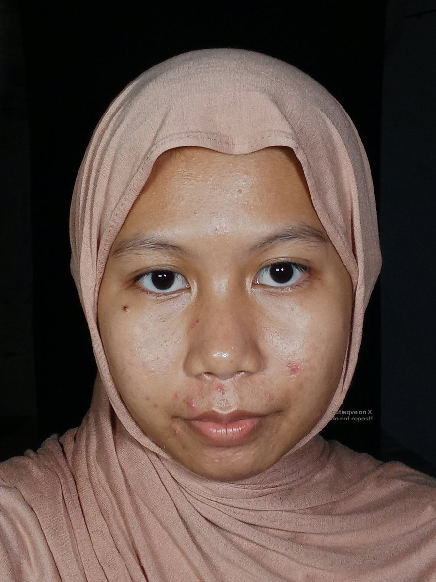 cutieqve's tweet photo. tau gak SOMETHINC PUNYA MICELLAR WATER BARU... dan ini before-after di kulitku. sekalian aku share experience pemakaian nya ⤵️

before                                     after https://t.co/7gkZCL8S4E