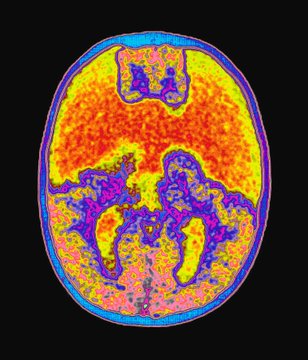 Your brain has been fooling you your entire life.

This Nobel Prize winner spent 40 years proving it.

Here are the 10 mental traps controlling every decision you make: 🧵