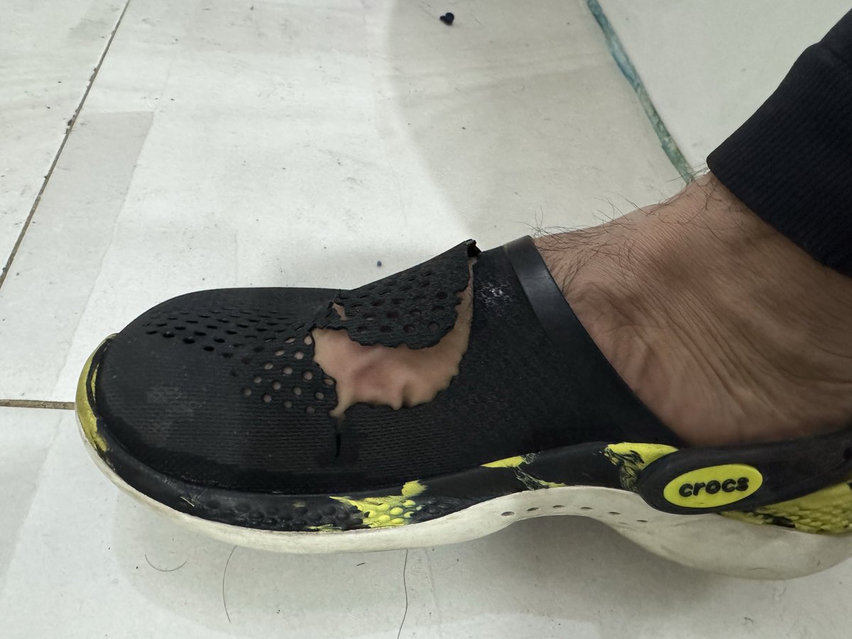 Henry__Squire's tweet photo. Que pasó con tu calidad @Crocs? solo 4 meses de uso y ya están rotas, tengo otros 2 modelos igual que estas y también se rompieron de la misma forma #crocs #poorquality https://t.co/x6mrL73YVK