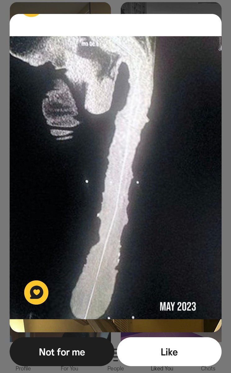 𝑩𝒖𝒎𝒃𝒍𝒆 𝑺𝒖𝒑𝒓𝒆𝒎𝒂𝒄𝒚 tweet media