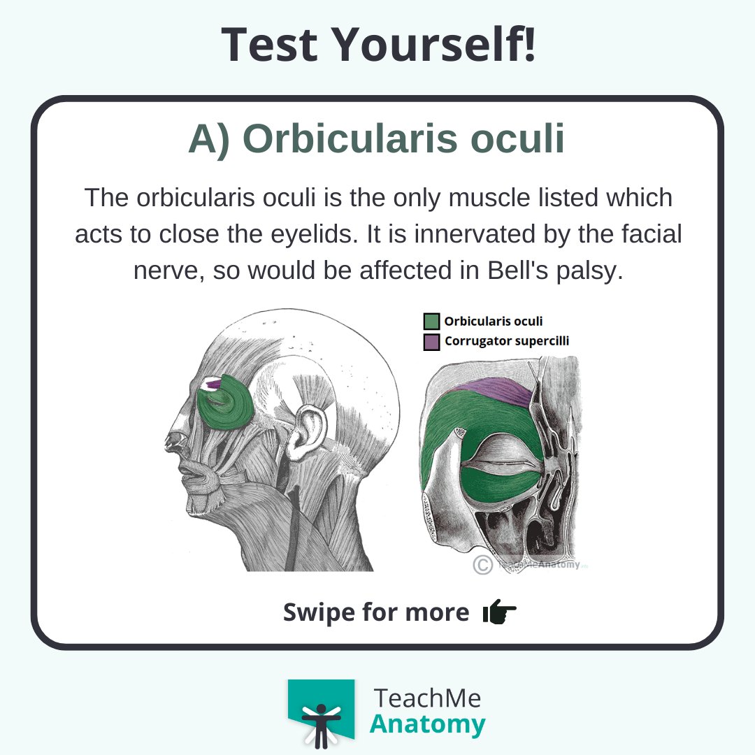 TeachMe_Support's tweet image. Test your clinical knowledge!🏆 Which muscle has been affected? #quiztime #QuizoftheWeek  #quizoftheday #medschool #medicalstudent #medstudent #premed #premedlife #nursing #nursingschool #pastudent #physician #futuredoctor #premed #studymotivation #medlife #surgery #juniordoctors