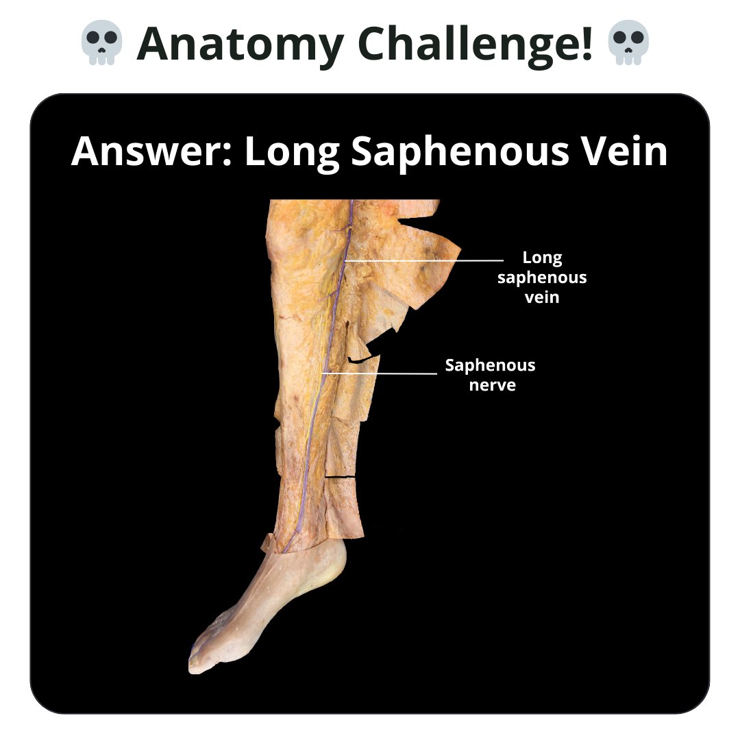 TeachMe_Support's tweet image. Anatomy challenge of the week 🏆 Can you name the structure? #quizyourself #meded #medschool #medicalstudent #medstudent #premed #premedlife #nursing #nursingschool #pastudent #physician #futuredoctor #studymotivation #medlife #surgery #medschoolmemes #medicalmeme