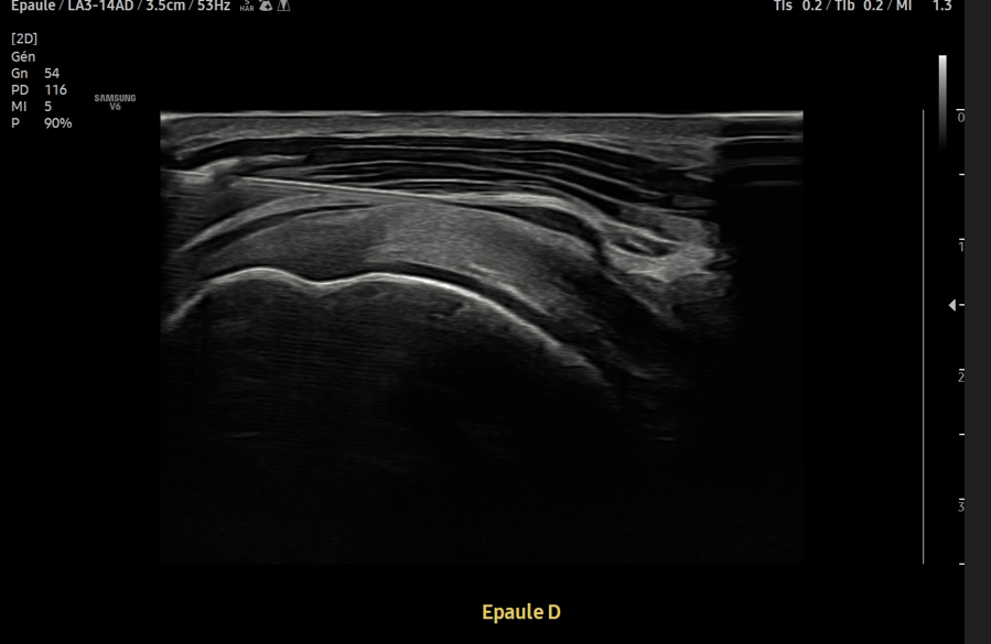 No SuperDoc tweet media