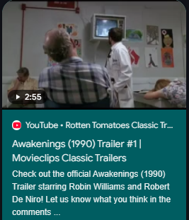 ExcelForU's tweet image. Awakenings is a 1990 American biographical drama film directed by Penny Marshall and written by Steven Zaillian, based on Oliver Sacks's 1973 memoir....
Is Awakenings 1990 true story?