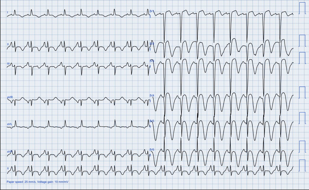 Dr. Andreas Roeschl tweet media