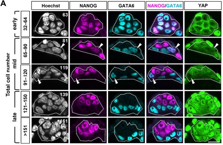 Fate specification triggers a positive feedback loop of TEAD–YAP and NANOG to promote epiblast formation in preimplantation embryos

Read this Research Article by Naoki Hirono, Masakazu Hashimoto, Hiromi Shimojo &amp; Hiroshi Sasaki:
journals.biologists.com/dev/article/15…