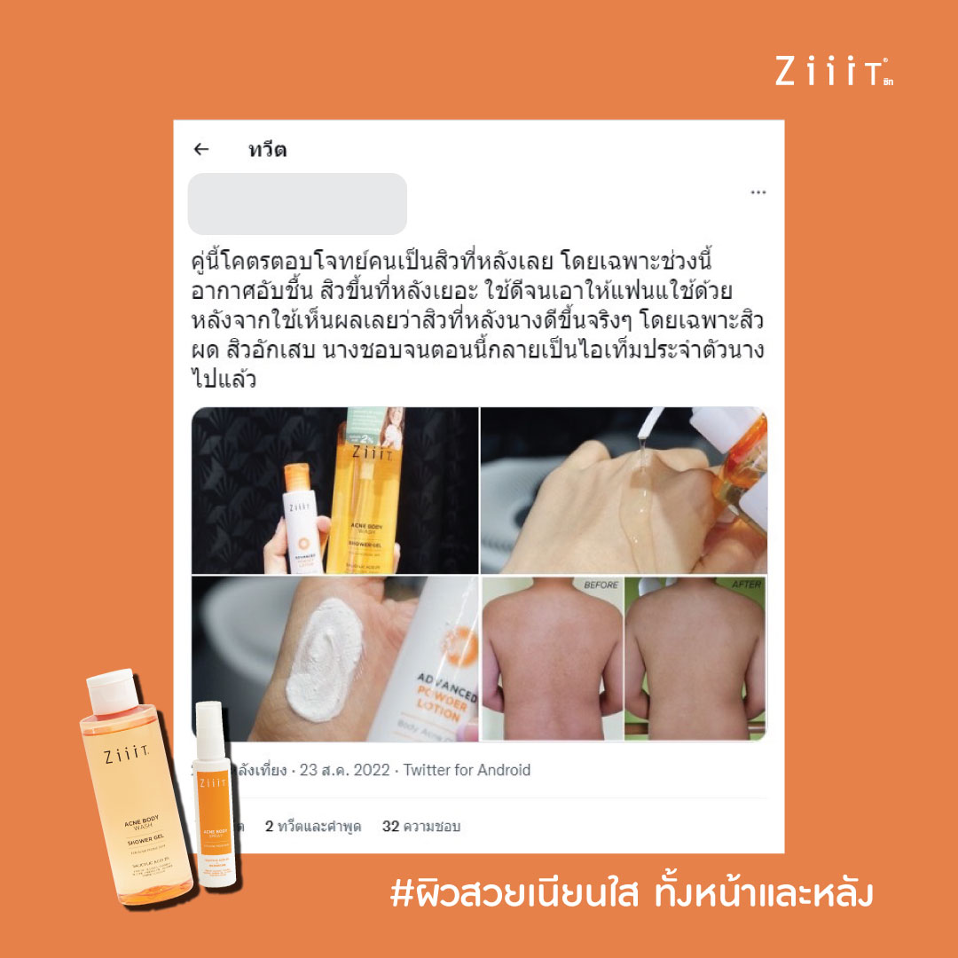Review จากผู้ใช้จริง!!!
ZiiiT Acne Body Wash + ZiiiT Acne Body Spray 
คู่หูผิวสวย เนียนใส 
บอกเลยผิวลูกคุณหนูอย่างเราก็สามารถใช้ได้ https://t.co/ar67fzA45K