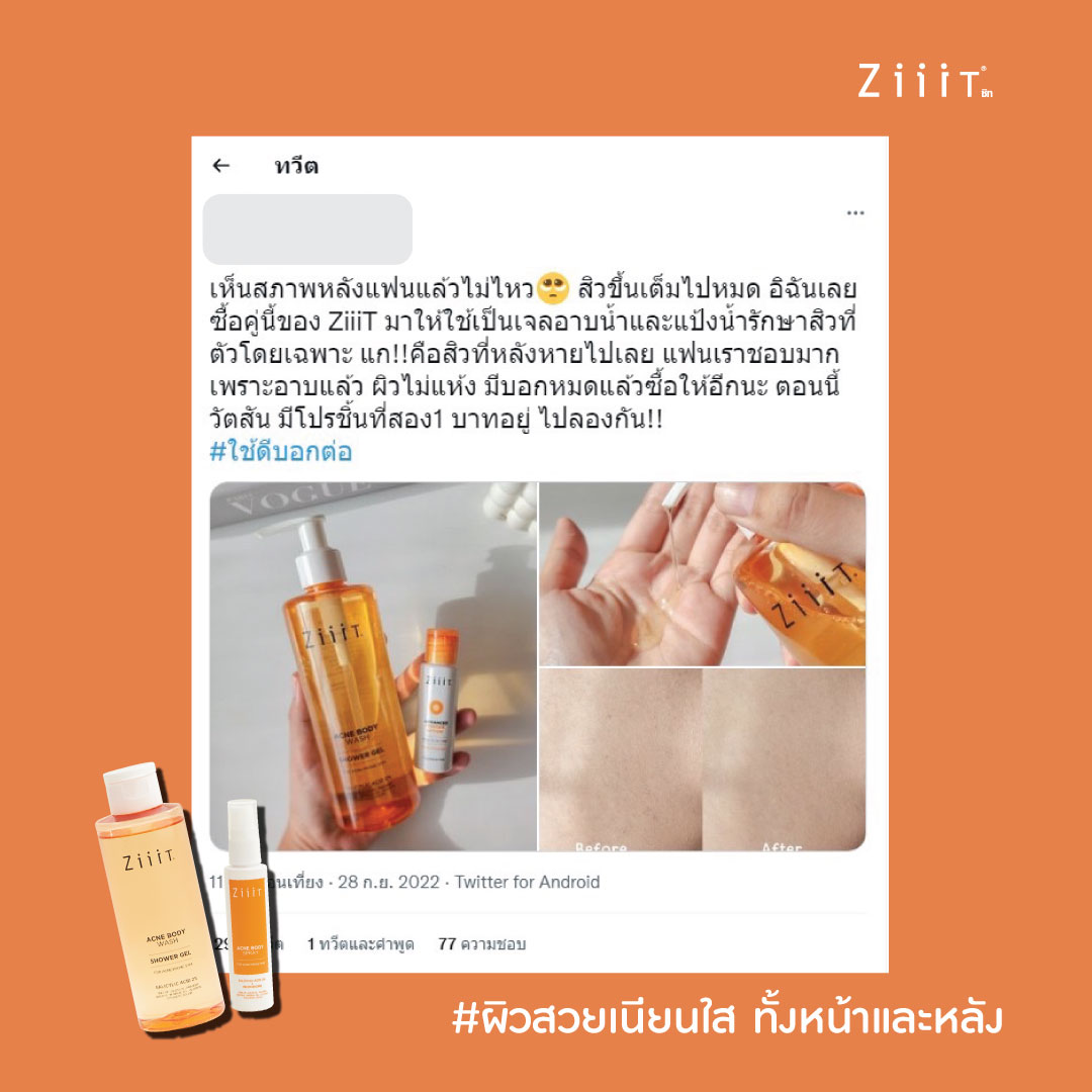 Review จากผู้ใช้จริง!!!
ZiiiT Acne Body Wash + ZiiiT Acne Body Spray 
คู่หูผิวสวย เนียนใส 
บอกเลยผิวลูกคุณหนูอย่างเราก็สามารถใช้ได้ https://t.co/ar67fzA45K