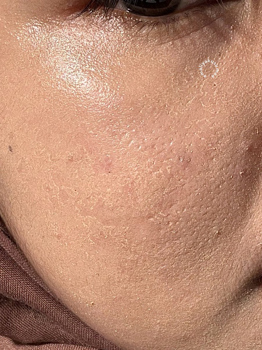 amaliyakusumaa's tweet photo. BEST PENEMUAN 2024; trial &amp; error make up hacks from MUA

dijamin make up auto nempel &amp; ga bikin crack.... dan yang pastinya aman buat dipakai dikegiatan sehari-hari ya shay.... WAJIB SAVE &amp; NYIMAK⤵️

before                                       after https://t.co/t11a8oV83B