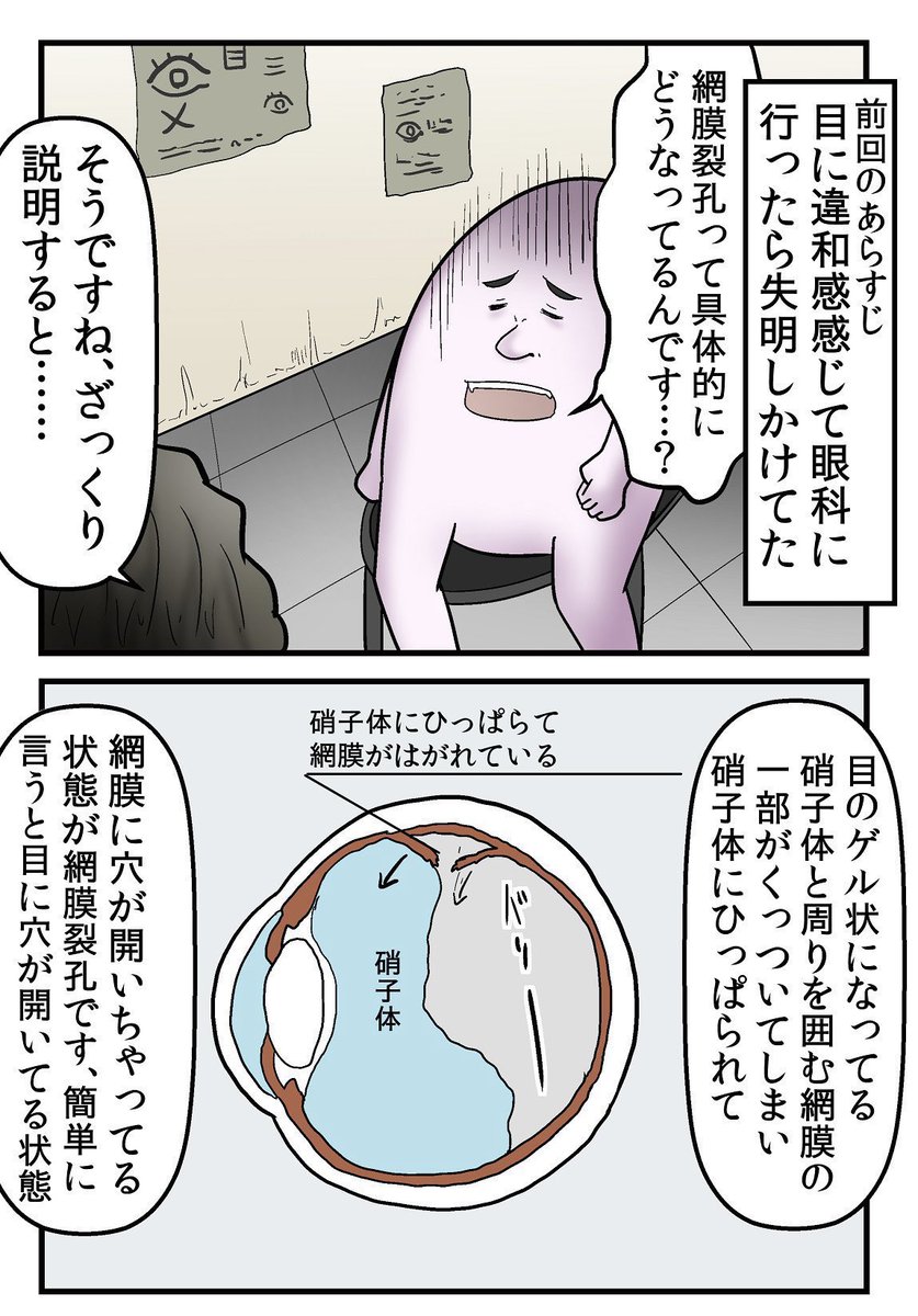 目に穴が開いて失明しかけた話 2/5 