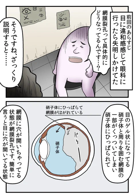 目に穴が開いて失明しかけた話 2/5 