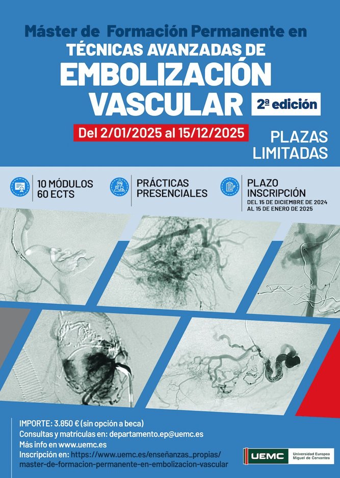 🎓 Máster de Formación Permanente en Técnicas Avanzadas de Embolización Vascular (2ª edición)
¡Plazas limitadas!
Del 02/01/2025 al 15/12/2025
10 mód | 60 ECTS | Prácticas presenciales
Inscripción: Hasta el 15/01/25
Importe: 3.850 € 
Consultas: departamento.ep@uemc.es