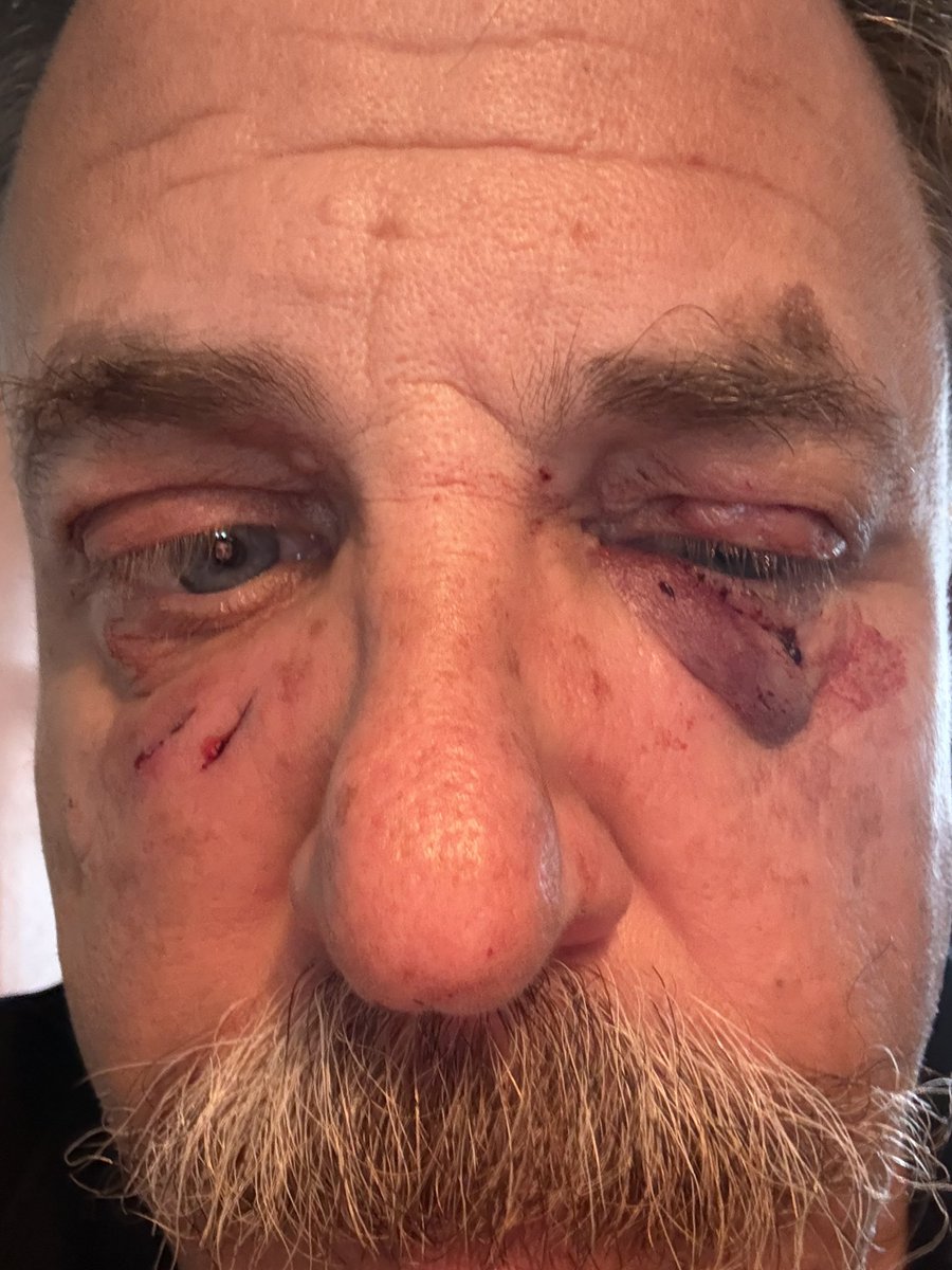 DIG CONANIZED tweet media