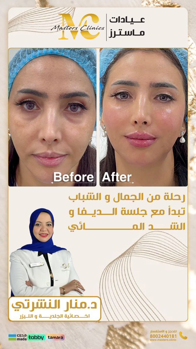 دكتورة منار النشرتي 
أخصائية الجلدية والليزر 

📍فرع مكة العوالي 

مجمع عيادات ماسترز الطبي العام
800 244 0181

 g.co/kgs/V91k4EK