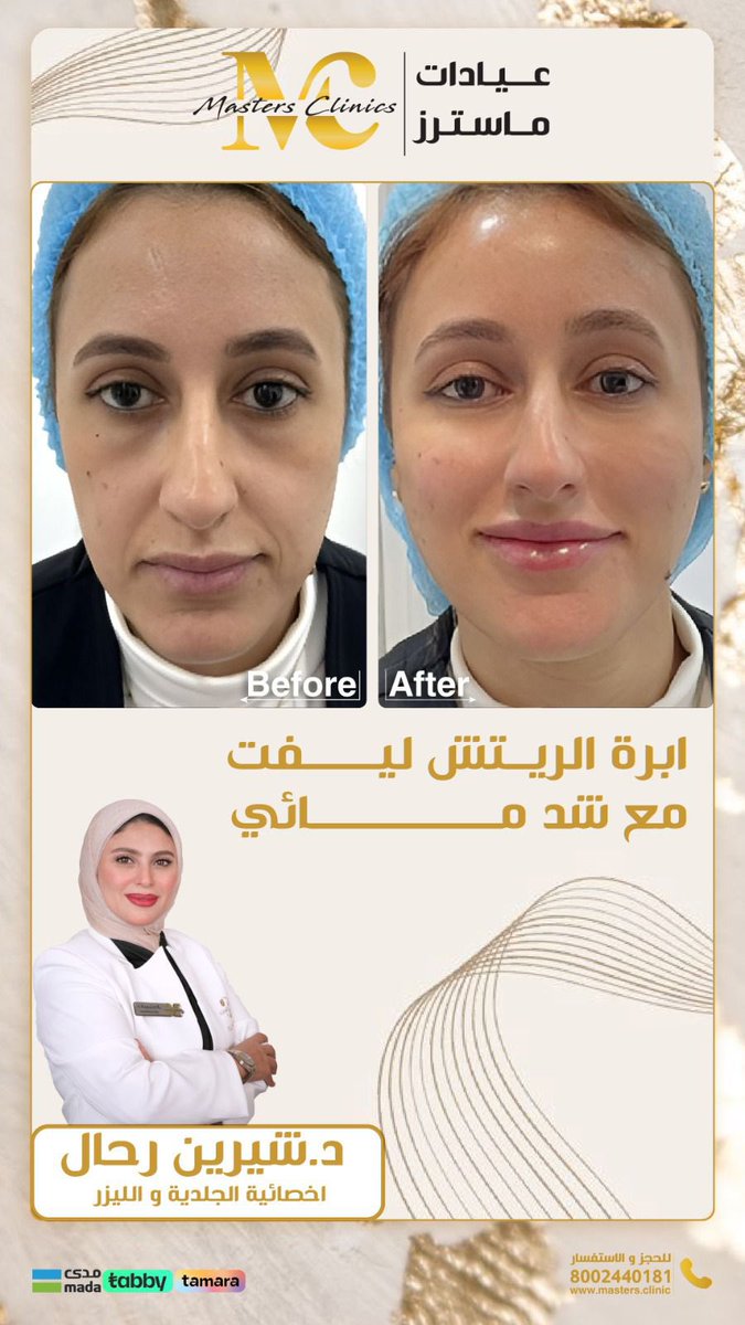 فريقنا الطبي في انتظار زيارتك للعناية بصحتك وجمالك في عيادات ماسترز ✨

د.شيرين رحال 
أخصائية الجلدية والليزر 

احجز الآن 
8002440181

📍فرع جدة حي الشاطيء 

 g.co/kgs/UtkoSSh