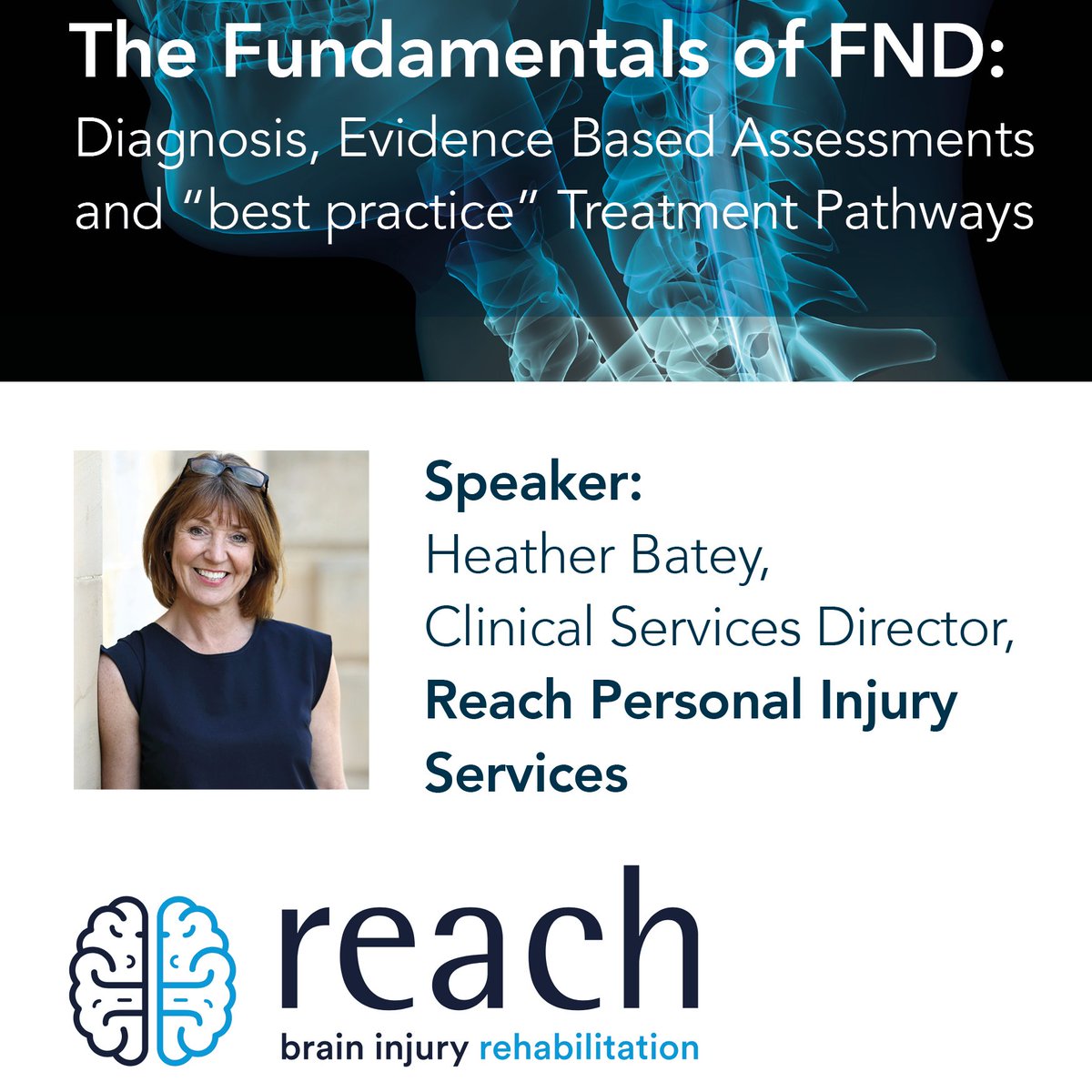 Register now for the first of our 2025 seminars. 

The Fundamentals of FND: Diagnosis, Evidence Based Assessments and “best practice” Treatment Pathways tinyurl.com/yc5jsaws 

<a href="/SintonsLaw/">Sintons LLP</a> <a href="/WaughNicki/">Nicki Waugh</a> <a href="/InjuryReach/">Reach Personal Injury Services</a> <a href="/stbiRehab/">Heather Batey</a> #FND #Seminar