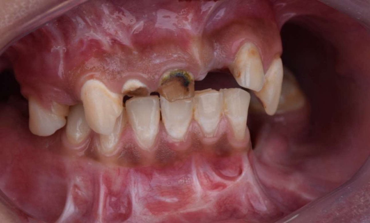 فايز المالكي tweet media