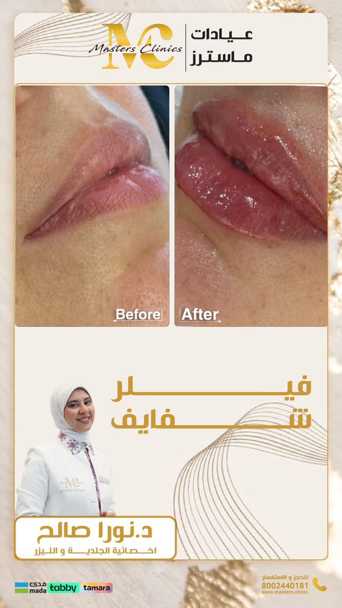 فريقنا الطبي في انتظار زيارتك للعناية بصحتك وجمالك في عيادات ماسترز ✨

د.نورا صالح 
اخصائية الجلدية والليزر 

احجز الآن 
8002440181

📍فرع جدة حي البساتين 

 g.co/kgs/cezXdHS