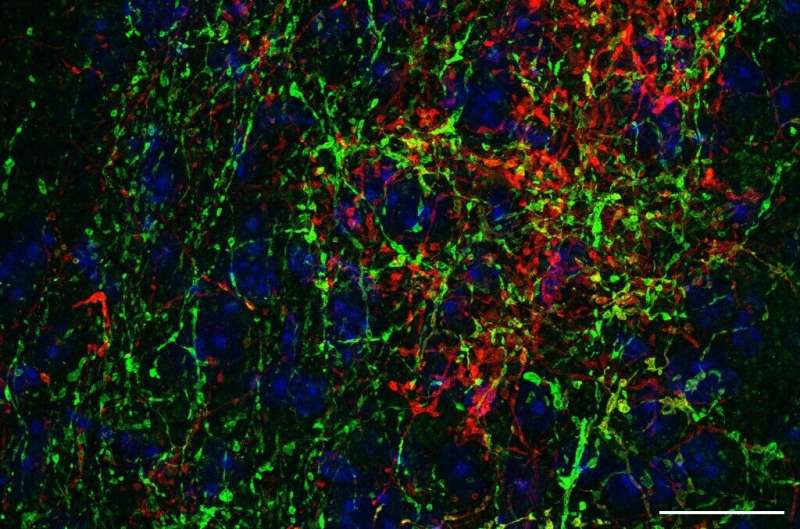 vita_pycode's tweet image. Recent study explores how #hearingloss may enhance the sense of touch🔍. The inferior colliculus, usually studied for sound processing, also processes tactile signals, leading to improved sensory experiences 🤯. bit.ly/4a2RKYI
#Audiology #Neuroscience #Research #Sensory