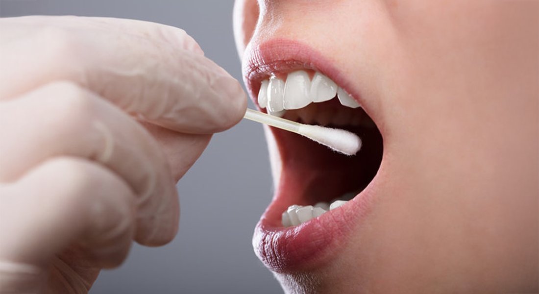 👄🦠 Salivary biomarkers as a diagnostic tool in type 2 diabetes
 
🔬 The Deshmukh and Hansen Groups have identified distinct molecular and taxonomic signatures in saliva associated with type 2 diabetes (T2D). 

💬“These findings open new avenues for research into the role of