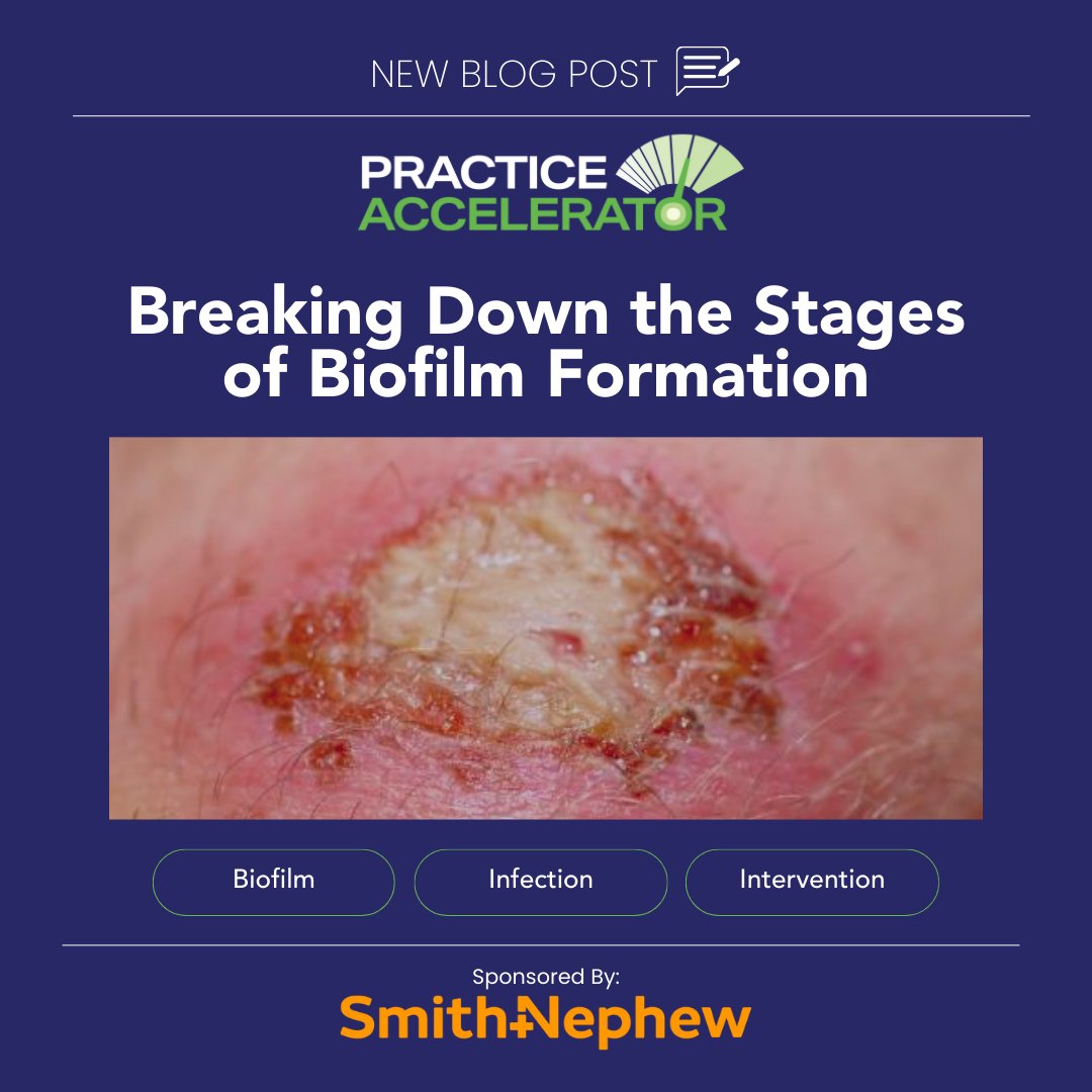 WoundSource's tweet image. 🔬 New Clinical Insights Post!

In this blog, Dr. Jennifer Spector outlines the multi-step biofilm formation process and its clinical implications.
okt.to/eYgd5U
Thank you to @smithnephew for supporting this month’s focus!
#WoundCare #Biofilm #PracticeAccelerator