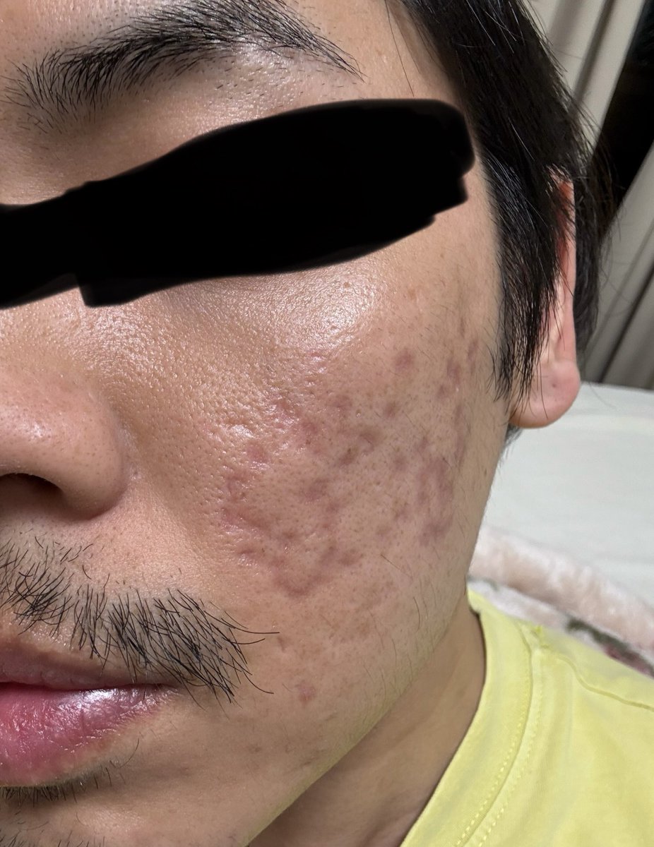 nikibman's tweet photo. 色んな角度から撮りました。
自分の体感ですが、薄くなっています。

自分用のメモとして投稿してますが、どなたかの参考になれば🙏 https://t.co/p3fFWKFyyA