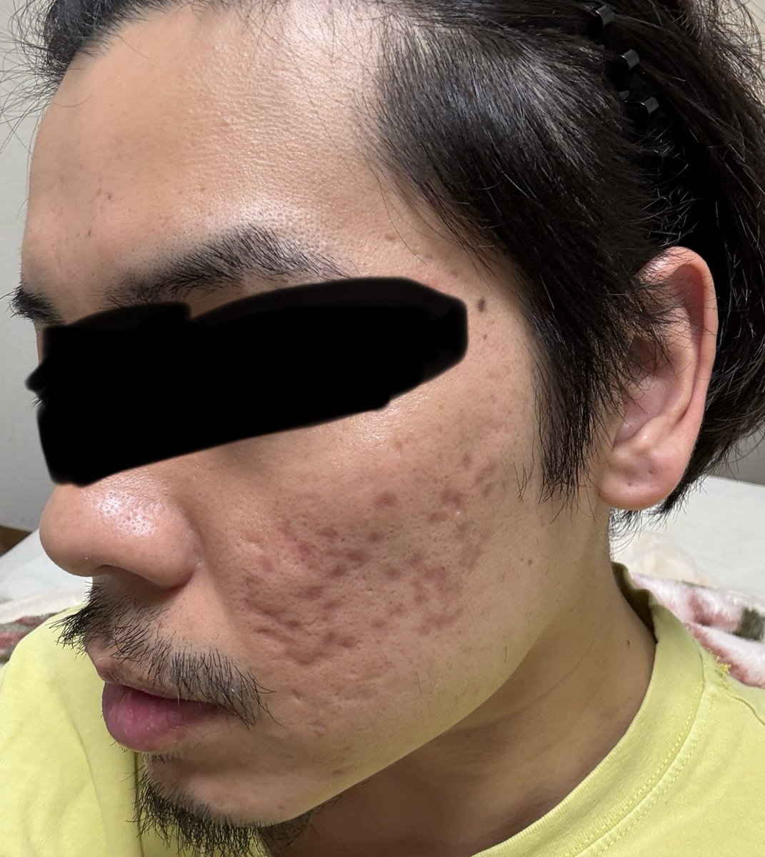 nikibman's tweet photo. 色んな角度から撮りました。
自分の体感ですが、薄くなっています。

自分用のメモとして投稿してますが、どなたかの参考になれば🙏 https://t.co/p3fFWKFyyA