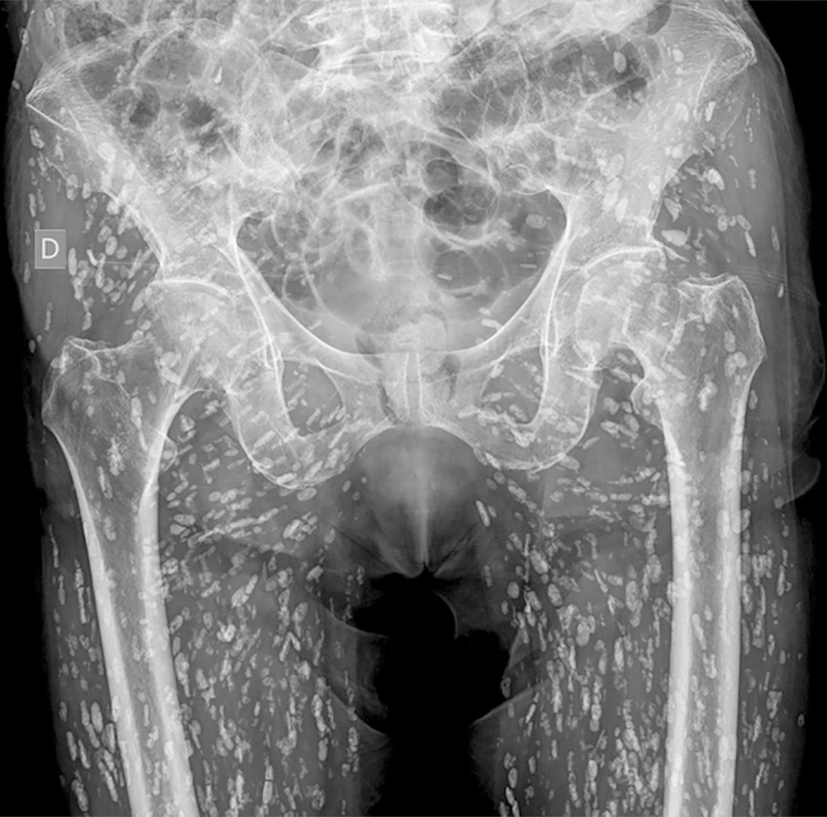 Sam Ghali, M.D. tweet media