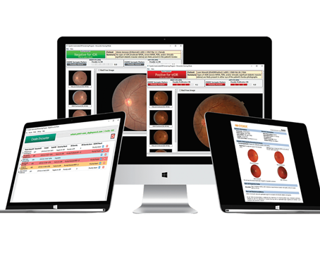 RevOphth's tweet image. Advancements in DR Screening Technology

These innovations may help catch more patients with diabetic retinopathy, including those in underrepresented populations: reviewofophthalmology.com/article/advanc…
#ophthalmology #ophthalmologist #eyedoctor #diabeticretinopathy #retina #diabetes