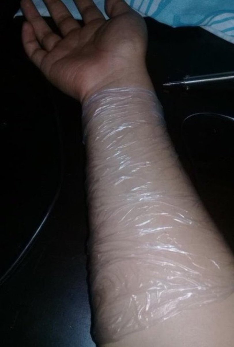 wjmartinv's tweet photo. Hasta donde llega el fanatismo.

Este cuate se tatuó en el brazo el listado de todos los logros del primer año de @GuatemalaGob del Presidente @BArevalodeLeon. 😱🌱 https://t.co/M2fWf8urYY