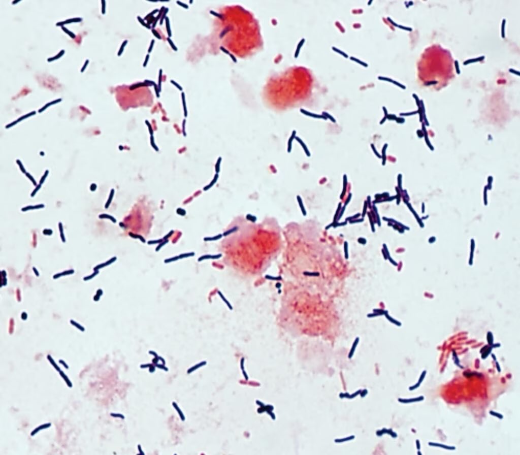 andresf_munoz's tweet photo. La bacteria Clostridium difficile no cambió de nombre, sino que se reclasificó el género Clostridium como Clostridioides, en 2016. 🧵 #medicine https://t.co/SxySfrmvdl